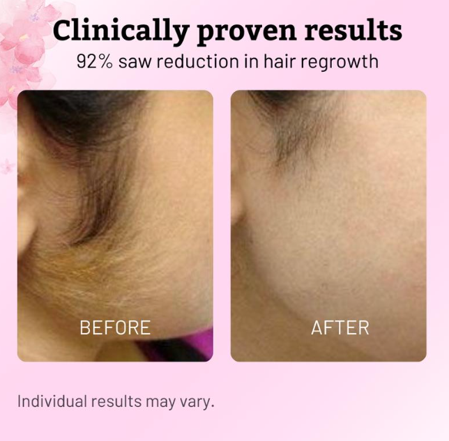 Lumora Cyperus Rotundus Oil