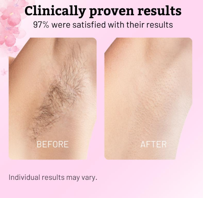 Lumora Cyperus Rotundus Oil