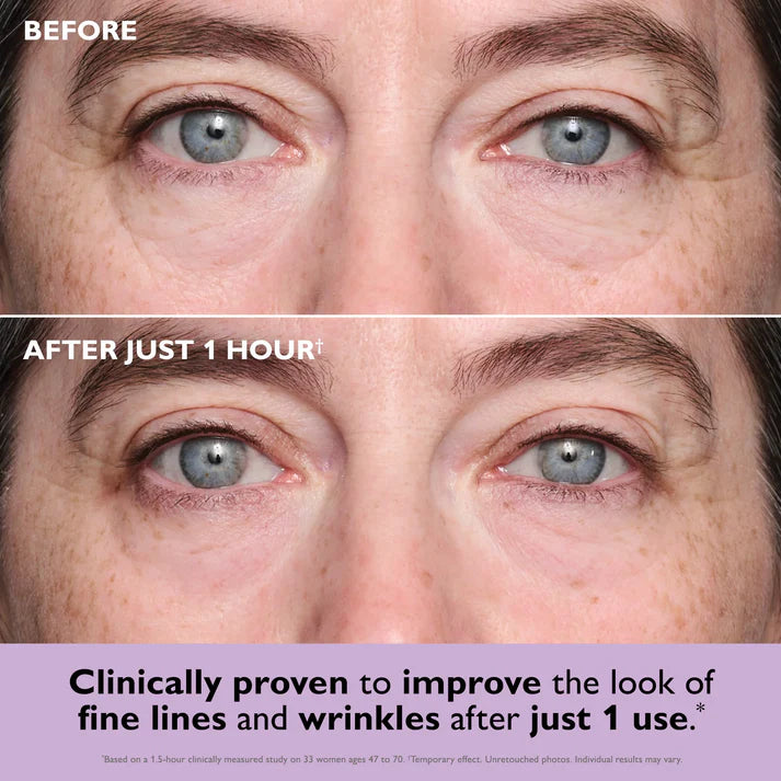 FirmX Collagen Infusion Eye Patches