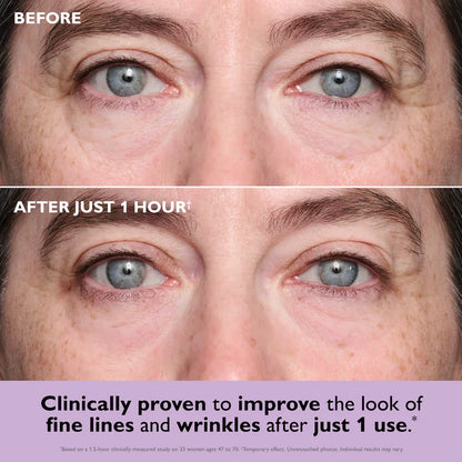 FirmX Collagen Infusion Eye Patches
