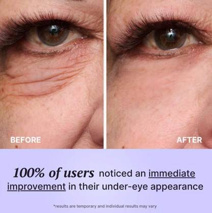 Firmx Instant Eye Tightener