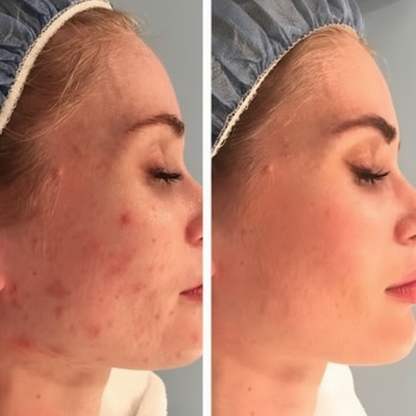 Lumora Smoothing Solution Ingrown Hair Treatment